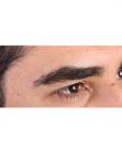 After Hair Transplant&nbsp;Eyebrows